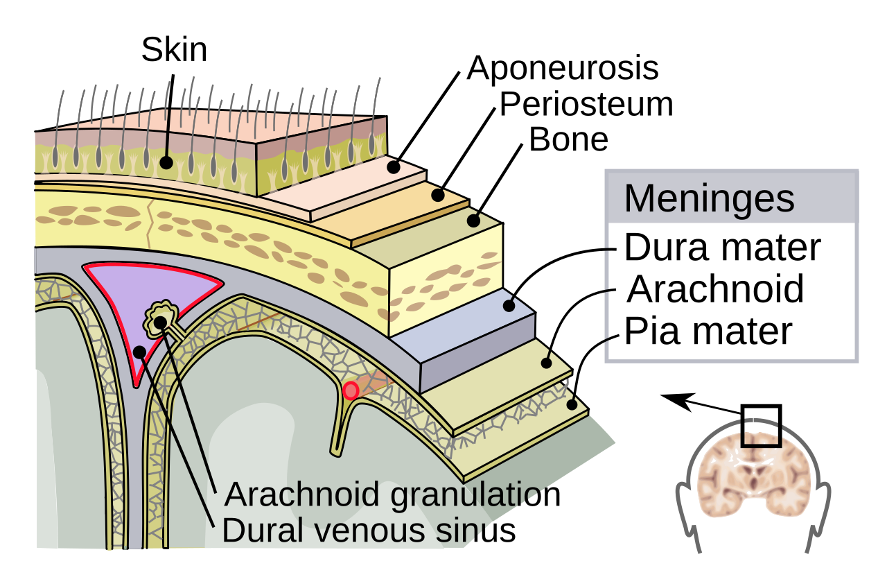 Meningitis Causes: Understanding Bacterial, Viral, and Prevention